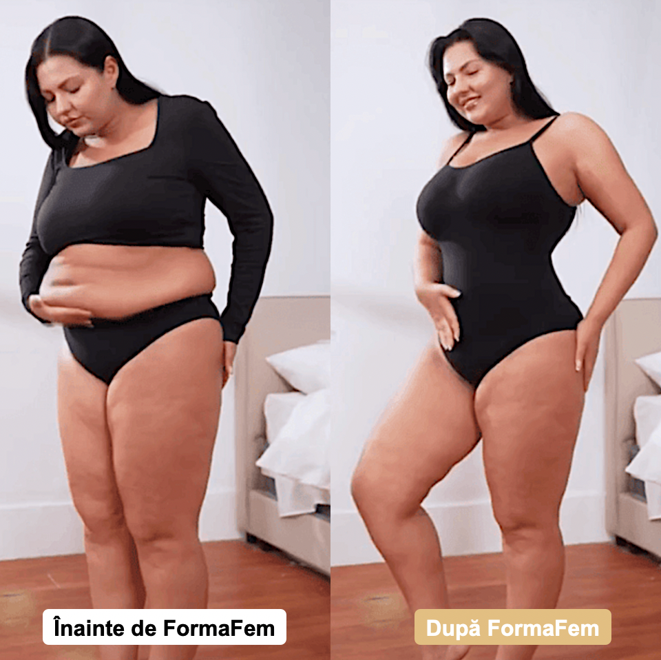 Body modelator FormaFem™